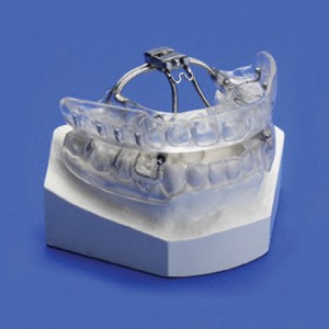 The KLEARWAY™ appliance for the treatment of snoring and obstructive sleep apnea.